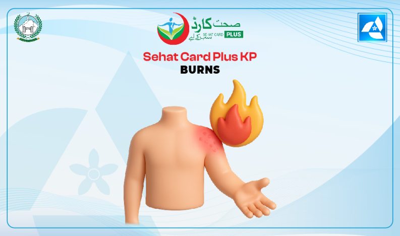 Sehat Card Plus KP Burns Treatment