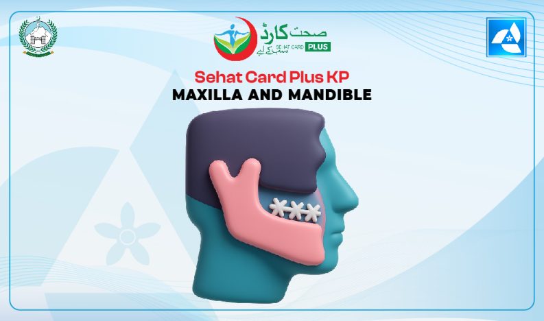 Sehat Card Plus KP Maxilla and Mandible Treatment Sehat Card Plus KP Maxilla and Mandible Treatment