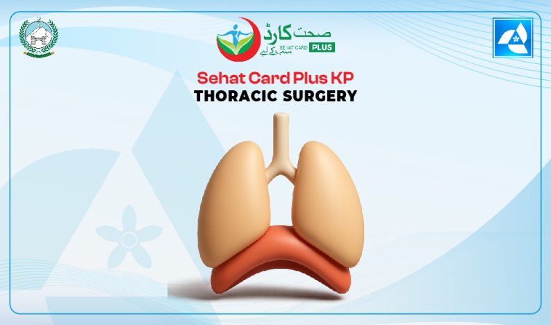 Sehat Card Plus KP Thoracic Surgery Treatment Sehat Card Plus KP Thoracic Surgery Treatment