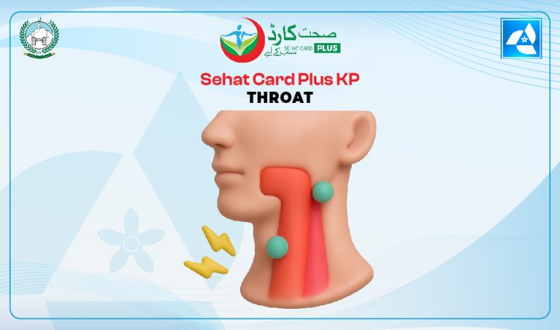 Sehat Card Plus KP Throat Treatment